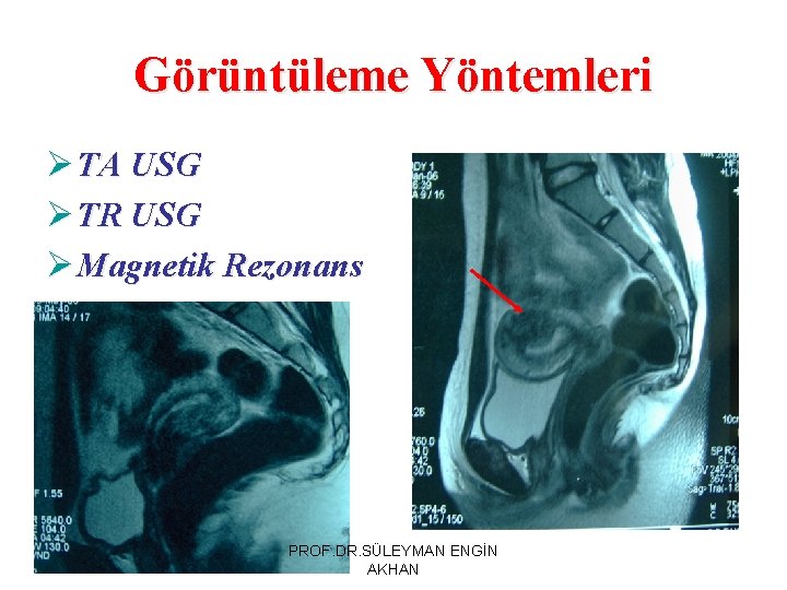 Görüntüleme Yöntemleri Ø TA USG Ø TR USG Ø Magnetik Rezonans PROF. DR. SÜLEYMAN