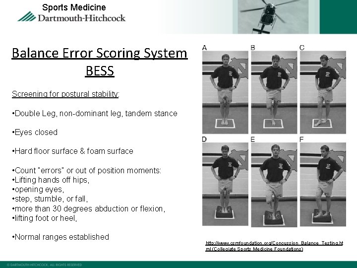 Sports Medicine Balance Error Scoring System BESS Screening for postural stability: • Double Leg,