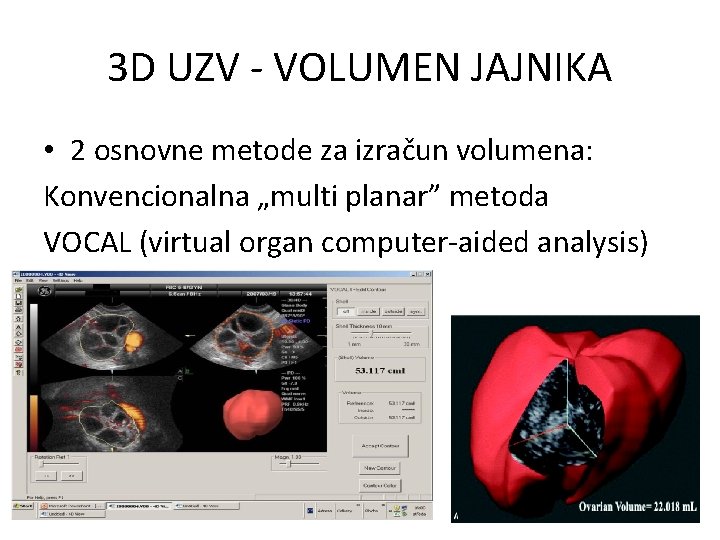 3 D UZV - VOLUMEN JAJNIKA • 2 osnovne metode za izračun volumena: Konvencionalna