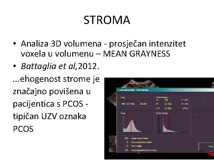 STROMA • Analiza 3 D volumena - prosječan intenzitet voxela u volumenu – MEAN