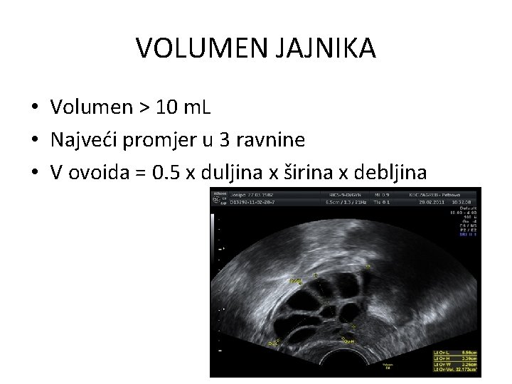 VOLUMEN JAJNIKA • Volumen > 10 m. L • Najveći promjer u 3 ravnine