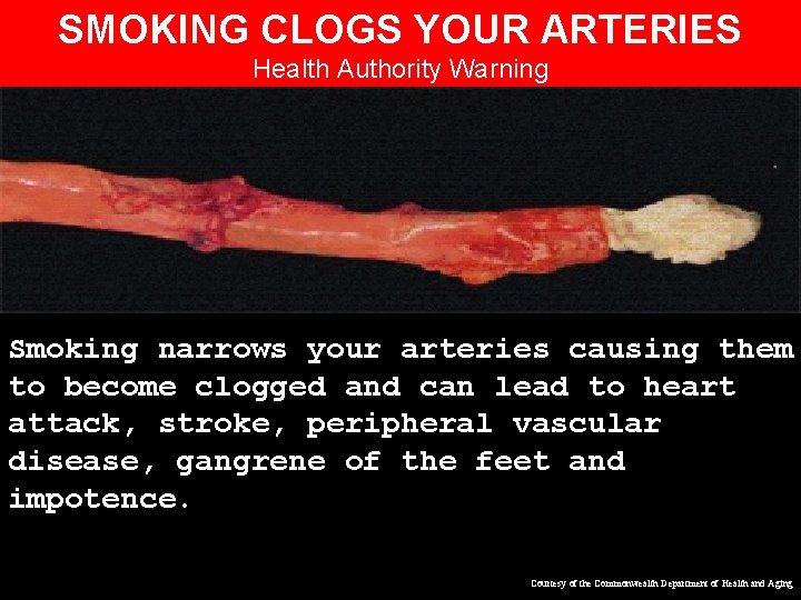 SMOKING CLOGS YOUR ARTERIES Health Authority Warning Smoking narrows your arteries causing them to