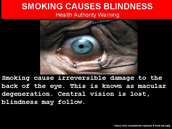 SMOKING CAUSES BLINDNESS Health Authority Warning Smoking cause irreversible damage to the back of