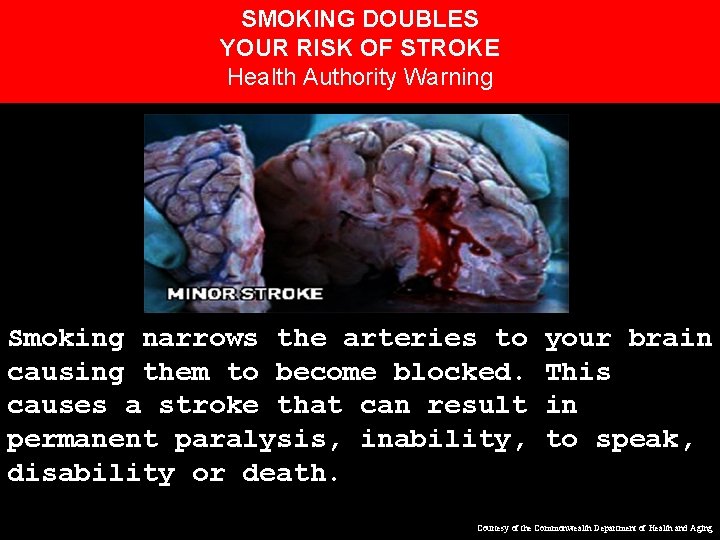 SMOKING DOUBLES YOUR RISK OF STROKE Health Authority Warning Smoking narrows the arteries to