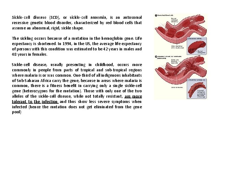 Sickle-cell disease (SCD), or sickle-cell anaemia, is an autosomal recessive genetic blood disorder, characterized