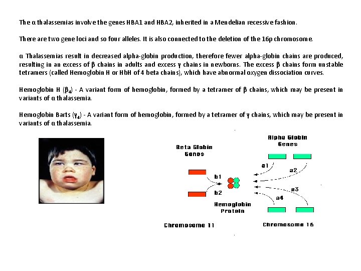 The α thalassemias involve the genes HBA 1 and HBA 2, inherited in a