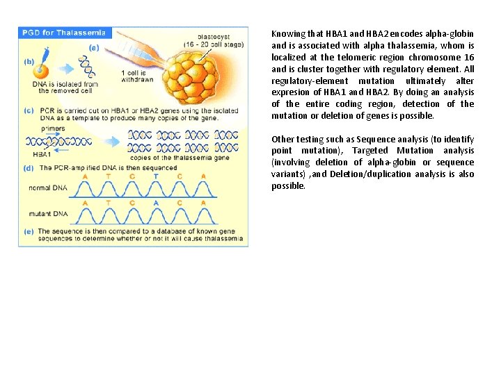 Knowing that HBA 1 and HBA 2 encodes alpha-globin and is associated with alpha