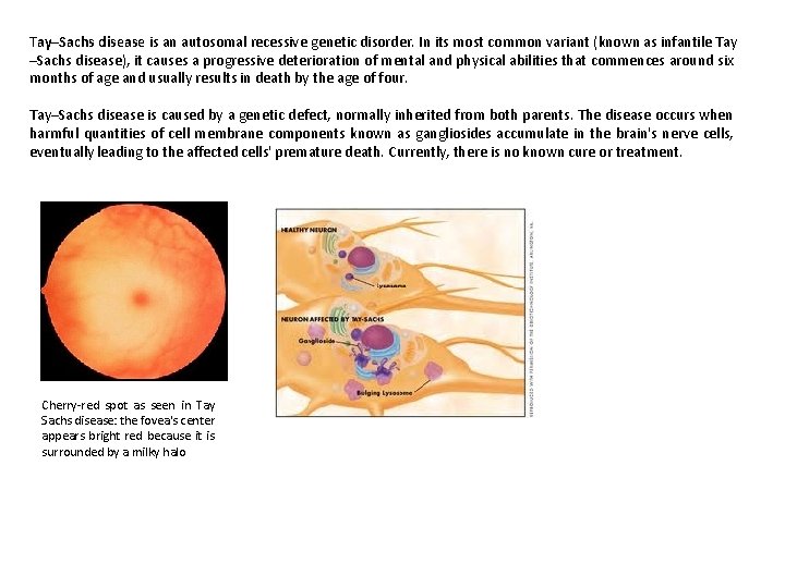 Tay–Sachs disease is an autosomal recessive genetic disorder. In its most common variant (known