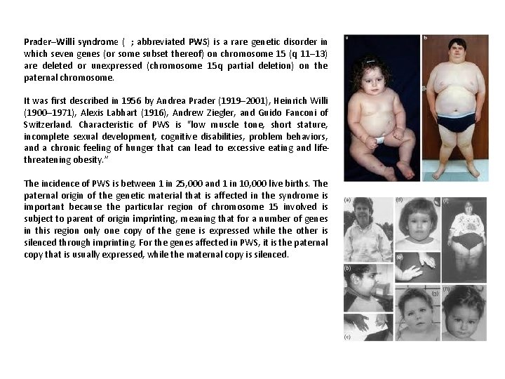 Prader–Willi syndrome ( ; abbreviated PWS) is a rare genetic disorder in which seven