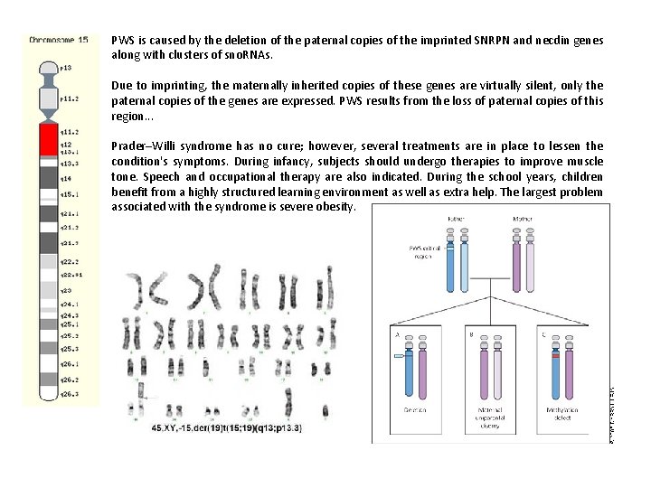 PWS is caused by the deletion of the paternal copies of the imprinted SNRPN