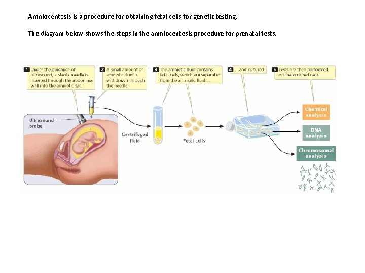 Amniocentesis is a procedure for obtaining fetal cells for genetic testing. The diagram below