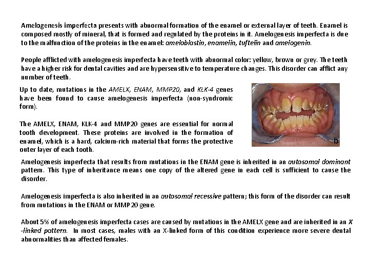 Amelogenesis imperfecta presents with abnormal formation of the enamel or external layer of teeth.