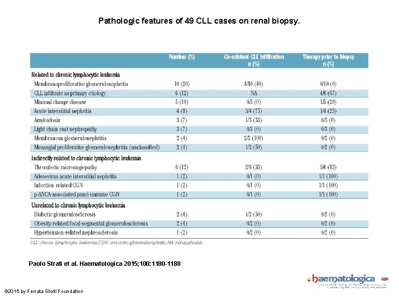 Pathologic features of 49 CLL cases on renal biopsy. Paolo Strati et al. Haematologica