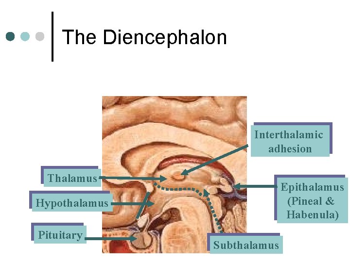 The Diencephalon Interthalamic adhesion Thalamus Epithalamus (Pineal & Habenula) Hypothalamus Pituitary Subthalamus 