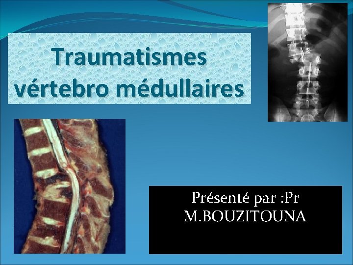 Traumatismes vértebro médullaires Présenté par : Pr M. BOUZITOUNA 