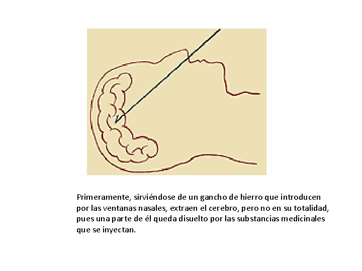 Primeramente, sirviéndose de un gancho de hierro que introducen por las ventanas nasales, extraen