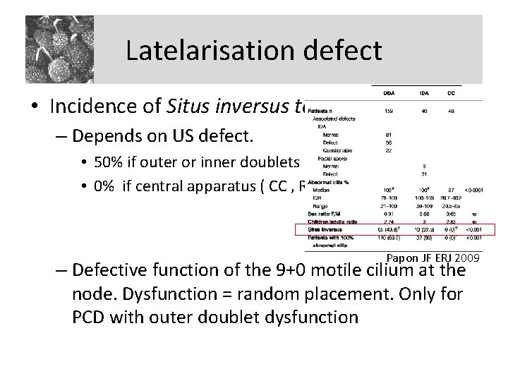 Latelarisation defect • Incidence of Situs inversus totalis – Depends on US defect. •