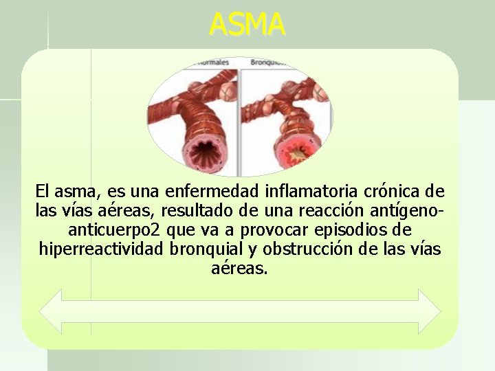 ASMA El asma, es una enfermedad inflamatoria crónica de las vías aéreas, resultado de