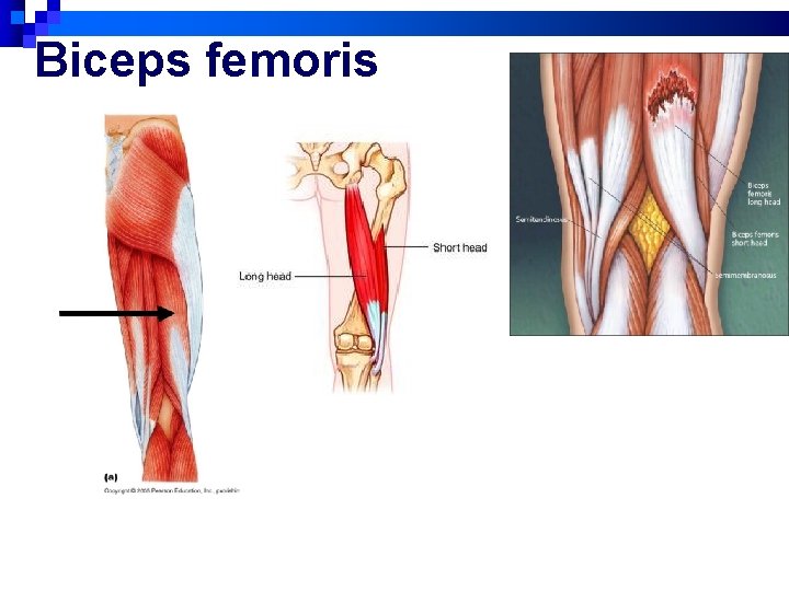 Biceps femoris 