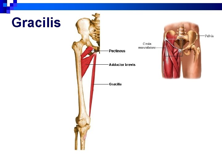 Gracilis 