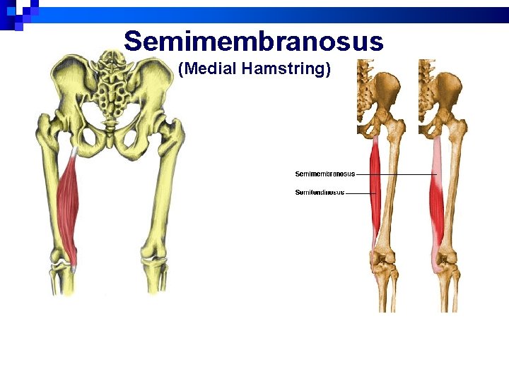 Semimembranosus (Medial Hamstring) 