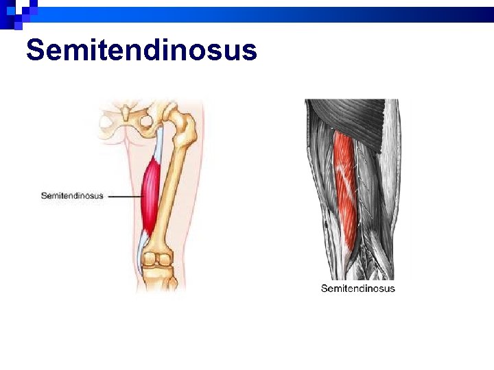 Semitendinosus 