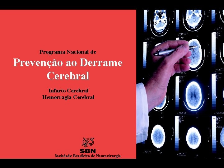 Programa Nacional de Prevenção ao Derrame Cerebral Infarto Cerebral Hemorragia Cerebral Sociedade Brasileira de