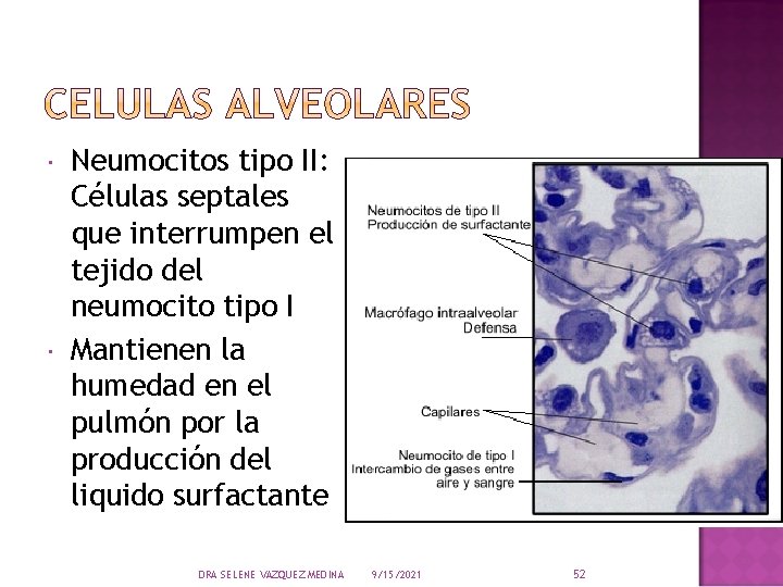  Neumocitos tipo II: Células septales que interrumpen el tejido del neumocito tipo I