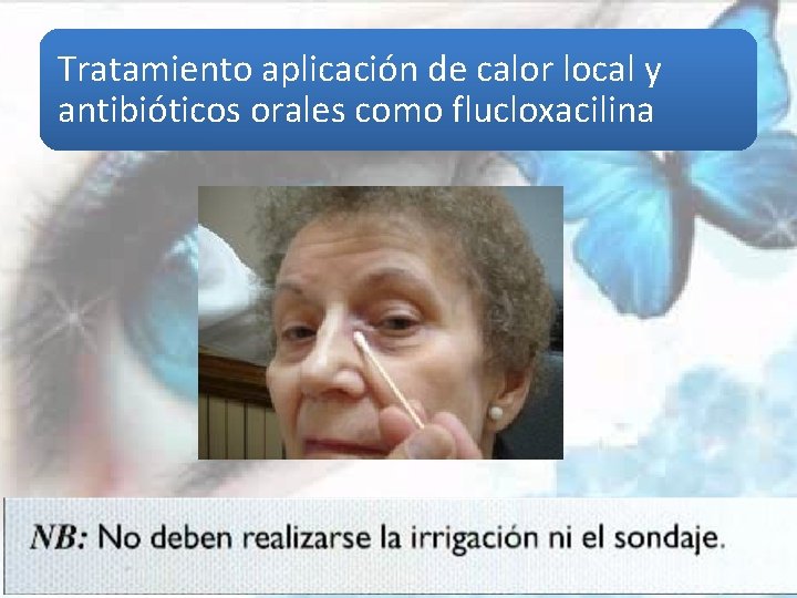 Tratamiento aplicación de calor local y antibióticos orales como flucloxacilina 
