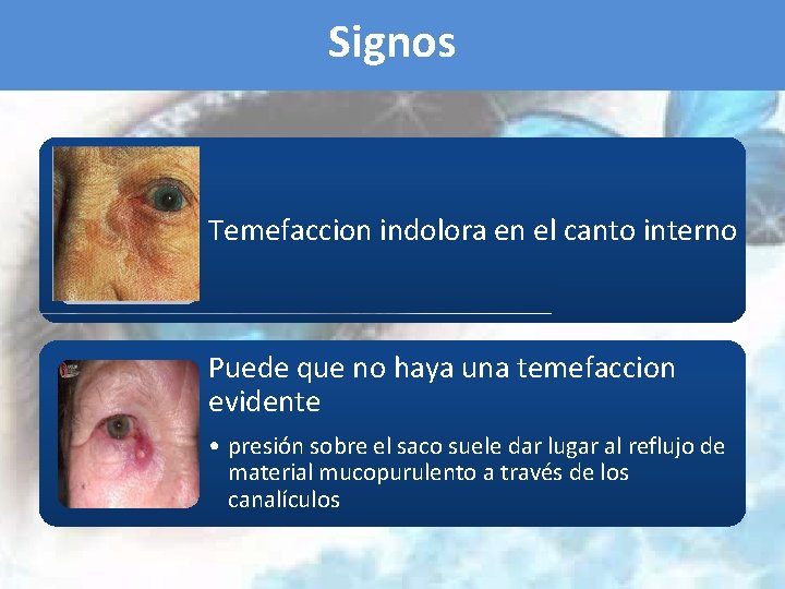 Signos Temefaccion indolora en el canto interno Puede que no haya una temefaccion evidente