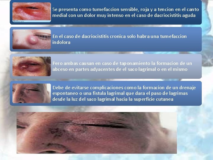 Se presenta como tumefaccion sensible, roja y a tencion en el canto medial con