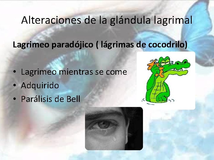 Alteraciones de la glándula lagrimal Lagrimeo paradójico ( lágrimas de cocodrilo) • Lagrimeo mientras