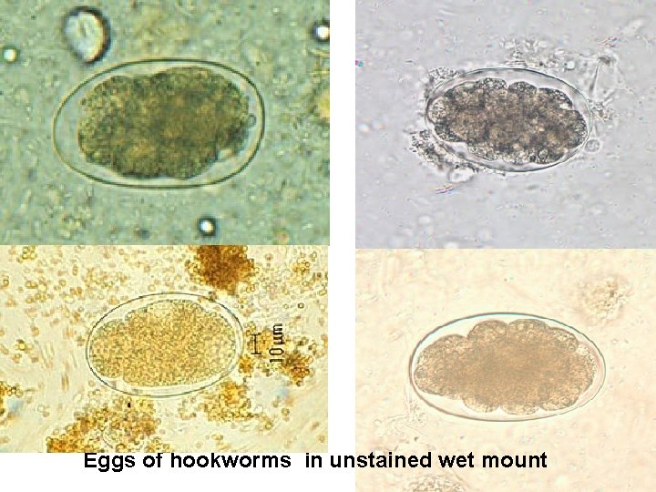 Eggs of hookworms in unstained wet mount 