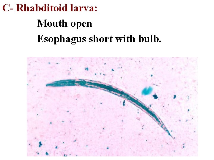 C- Rhabditoid larva: Mouth open Esophagus short with bulb. 