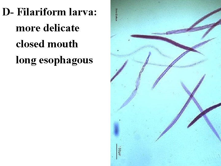 D- Filariform larva: more delicate closed mouth long esophagous 