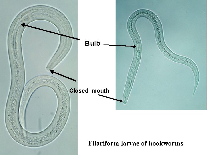 Bulb Closed mouth Filariform larvae of hookworms 