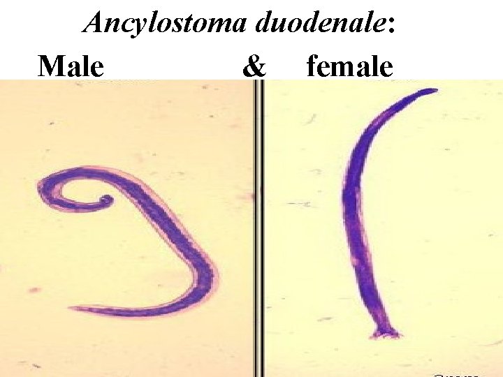 Ancylostoma duodenale: Male & female 