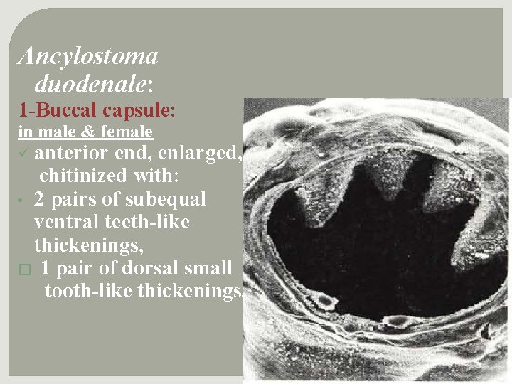 Ancylostoma duodenale: 1 -Buccal capsule: in male & female ü anterior end, enlarged, chitinized