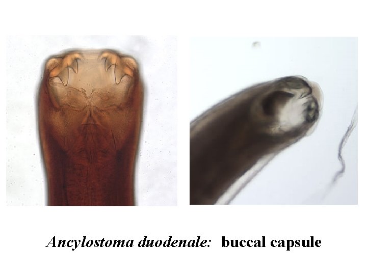 Ancylostoma duodenale: buccal capsule 
