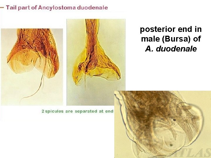 posterior end in male (Bursa) of A. duodenale 