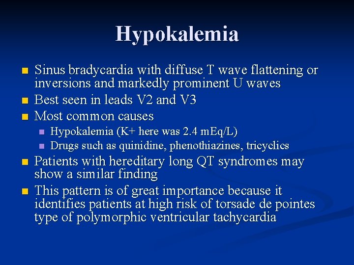 Hypokalemia n n n Sinus bradycardia with diffuse T wave flattening or inversions and
