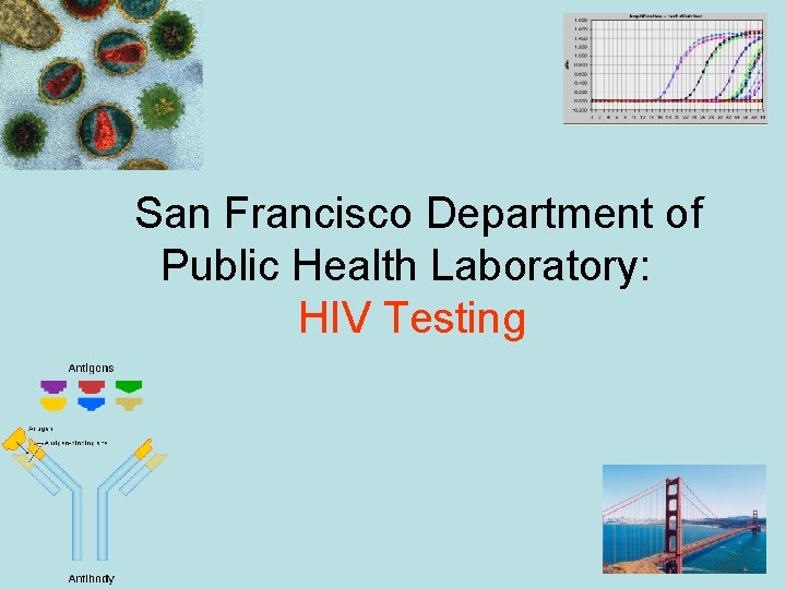 San Francisco Department of Public Health Laboratory: HIV Testing 