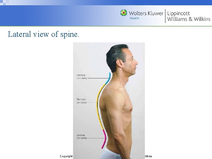 Lateral view of spine. Copyright © 2009 Wolters Kluwer Health | Lippincott Williams &