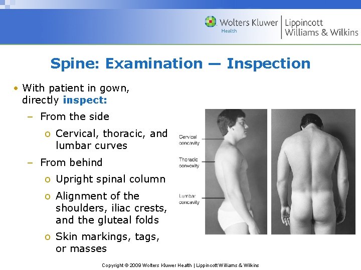 Spine: Examination — Inspection • With patient in gown, directly inspect: – From the