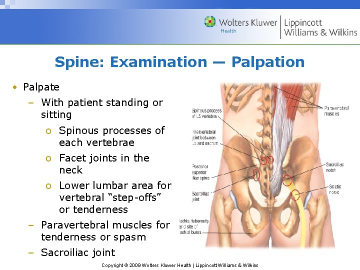 Spine: Examination — Palpation • Palpate – With patient standing or sitting o Spinous