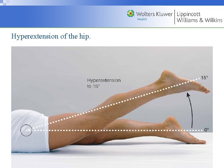 Hyperextension of the hip. Copyright © 2009 Wolters Kluwer Health | Lippincott Williams &
