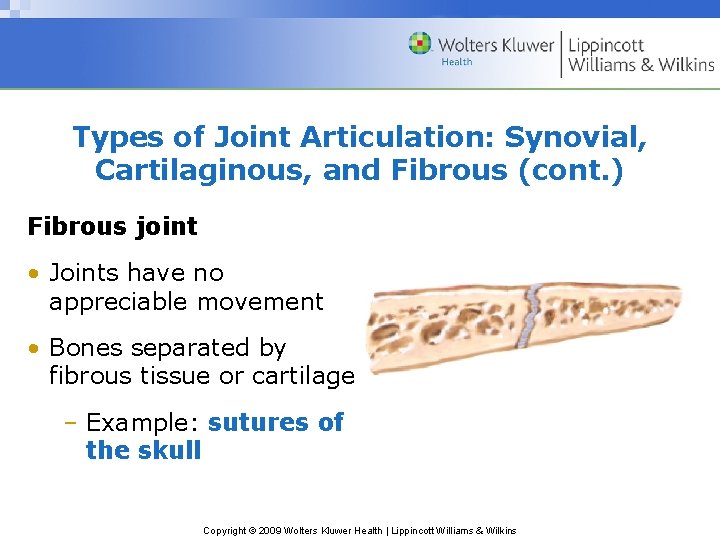 Types of Joint Articulation: Synovial, Cartilaginous, and Fibrous (cont. ) Fibrous joint • Joints