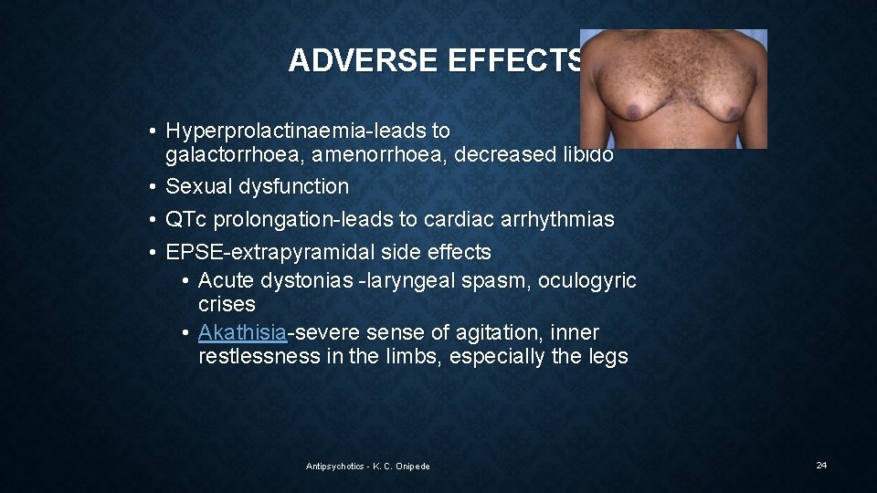 ADVERSE EFFECTS • Hyperprolactinaemia-leads to galactorrhoea, amenorrhoea, decreased libido • Sexual dysfunction • QTc