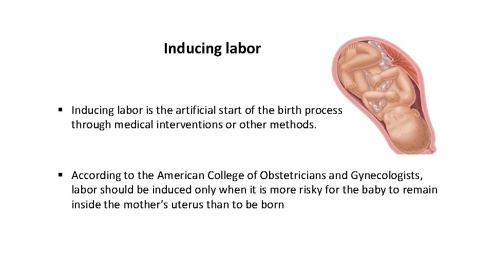 Inducing labor § Inducing labor is the artificial start of the birth process through