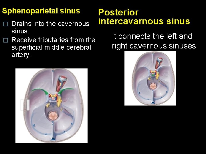 Sphenoparietal sinus Drains into the cavernous sinus. � Receive tributaries from the superficial middle